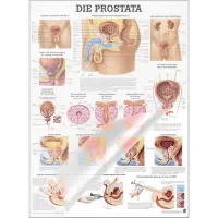Lehrtafel "Prostata" Prostata | Lehrtafel 70 x 100 cm | laminiert