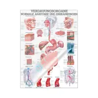 Verdauungsorgane - normale Anatomie u.  Erkrankungen Mini-Poster 24 x 34 cm | laminiert