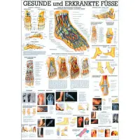 Gesunde und erkrankte Füße Lehrtafel 70x100cm | unlaminiert
