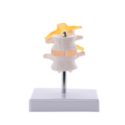 Anatomische Lendenwirbelsäule, 2tlg. 