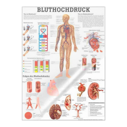 Bluthochdruck Bluthochdruck des Menschen | Poster 50 x 70 cm | laminiert