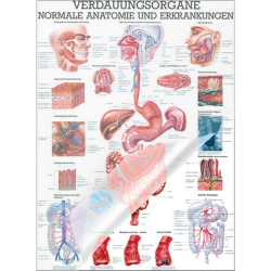 Verdauungsorgane - normale Anatomie u.  Erkrankungen Lehrtafel 70 x 100 cm | laminiert