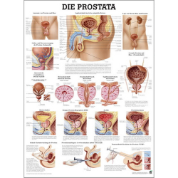 Lehrtafel "Prostata" Prostata | Lehrtafel 70 x 100 cm | unlaminiert