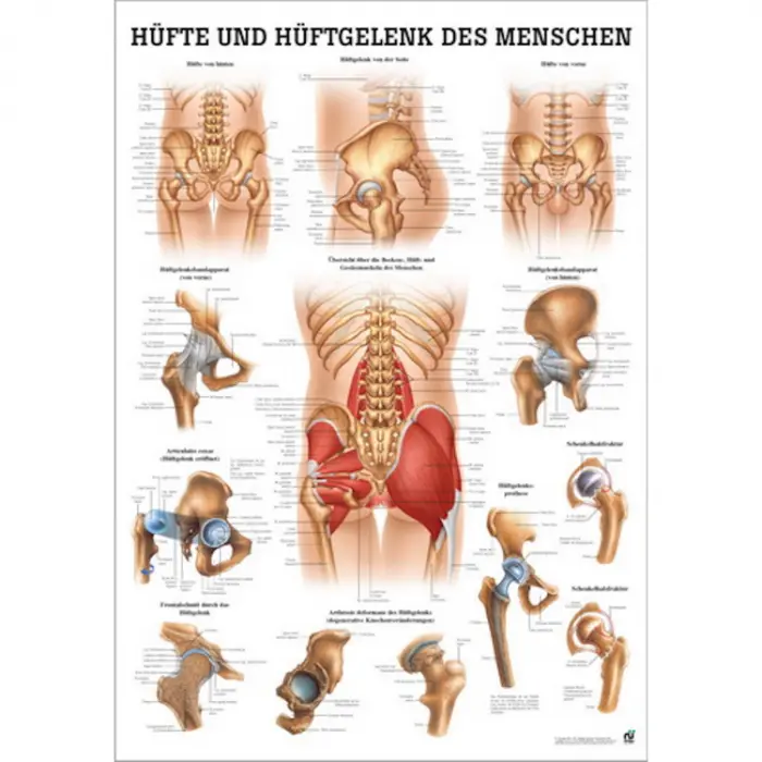 Hüfte und Hüftgelenke des Menschen Hüfte u. Hüftgelenke | Lehrtafel 70 x 100 cm | unlaminiert