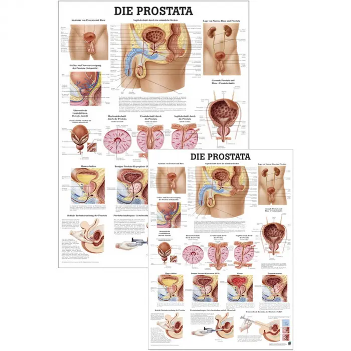 Lehrtafel "Prostata"