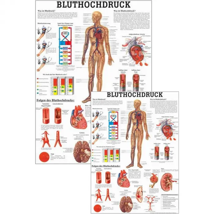 Bluthochdruck