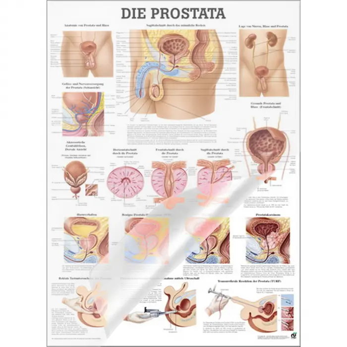 Lehrtafel "Prostata" Prostata | Lehrtafel 70 x 100 cm | laminiert