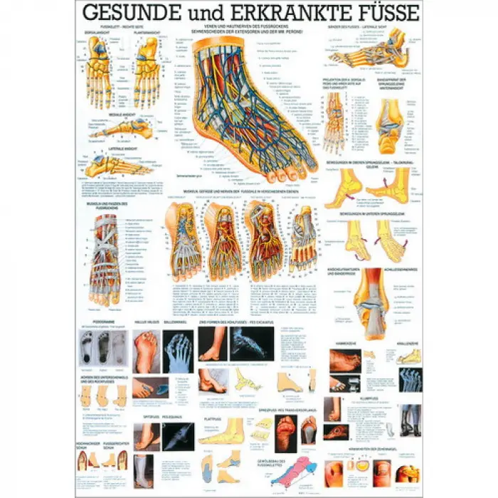 Gesunde und erkrankte Füße Lehrtafel 70x100cm | unlaminiert