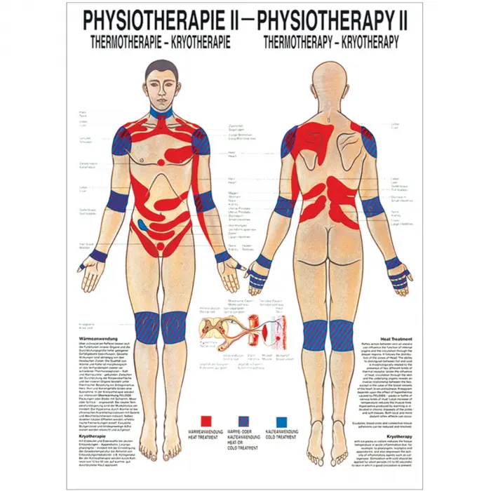 Physiotherapie II - Thermotherapie Mini-Poster 24 x 34 cm | unlaminiert