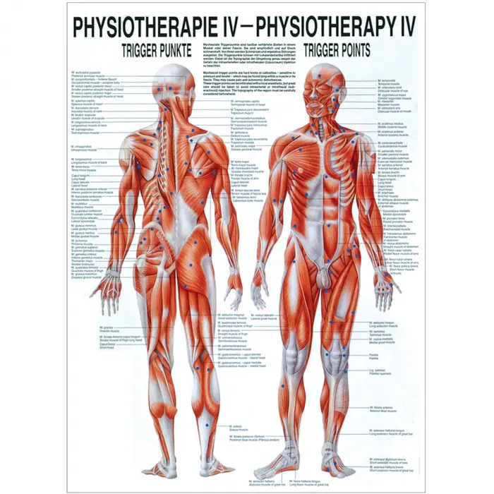Physiotherapie IV - Triggerpunkte Mini-Poster 24 x 34 cm | unlaminiert