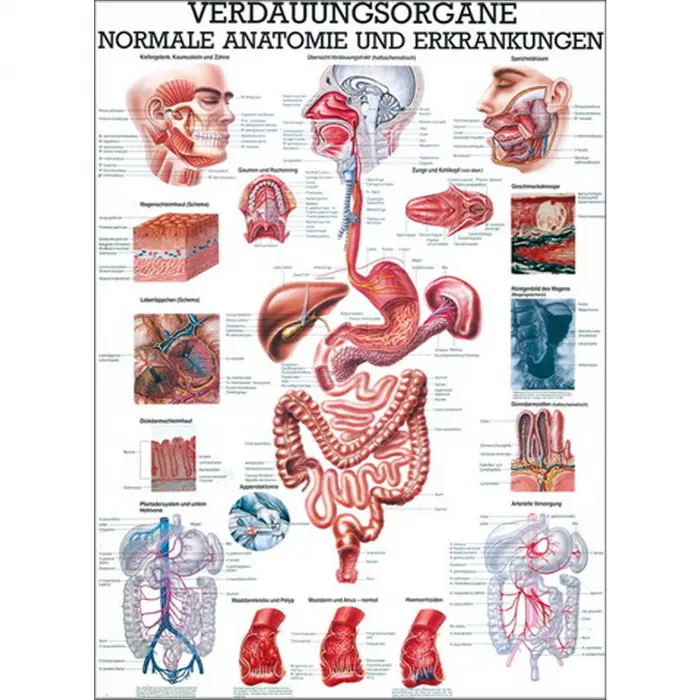 Verdauungsorgane - normale Anatomie u.  Erkrankungen Lehrtafel 70 x 100 cm | unlaminiert