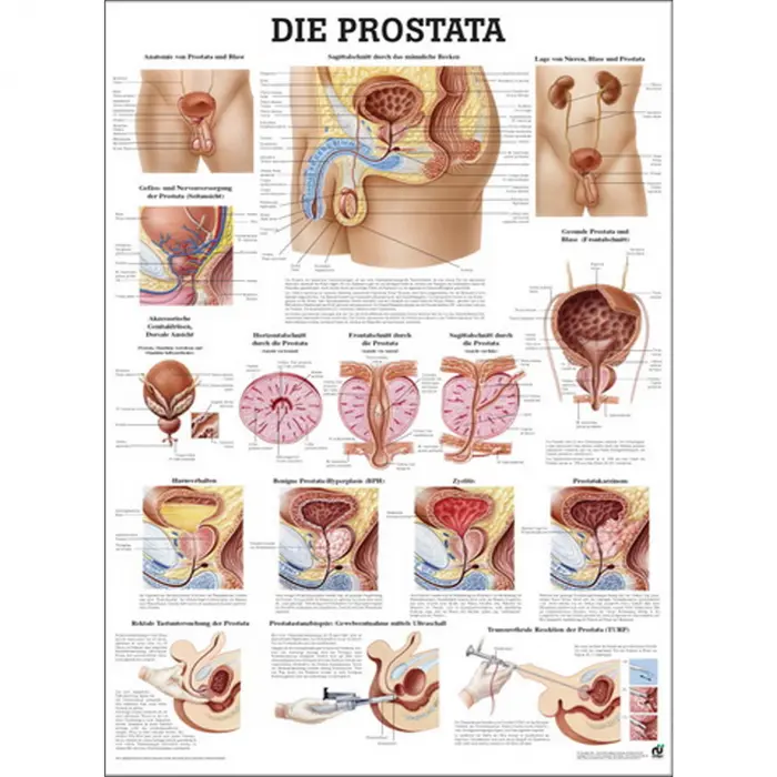 Lehrtafel "Prostata" Prostata | Lehrtafel 70 x 100 cm | unlaminiert