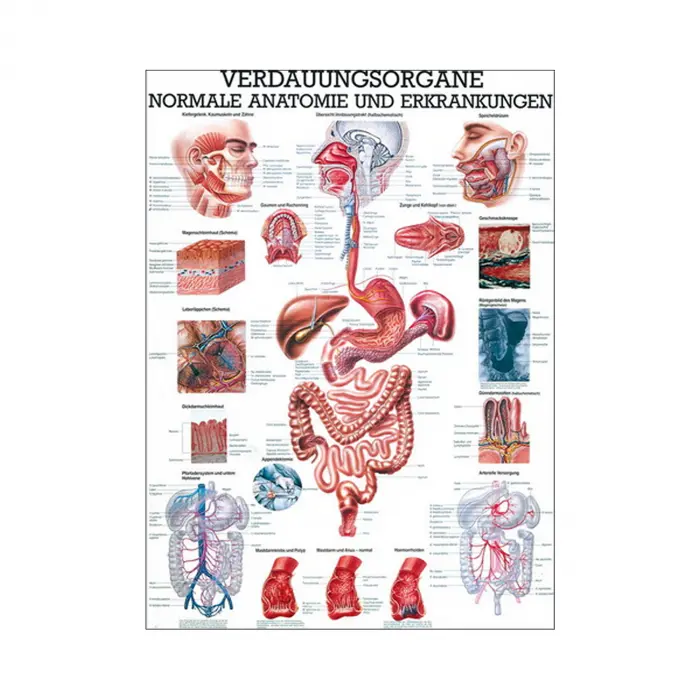 Verdauungsorgane - normale Anatomie u.  Erkrankungen Mini-Poster 24 x 34 cm | unlaminiert