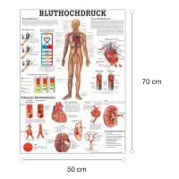 Bluthochdruck Bluthochdruck des Menschen | Poster 50 x 70 cm | unlaminiert