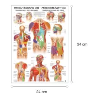 "Physiotherapie I-IX" Physio VIII-Triggerpunkte Kopf u. Rumpf | Mini-Poster 24 x 34 cm | unlaminiert