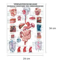 Verdauungsorgane - normale Anatomie u.  Erkrankungen Mini-Poster 24 x 34 cm | laminiert
