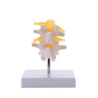 Anatomische Lendenwirbelsäule, 2tlg.