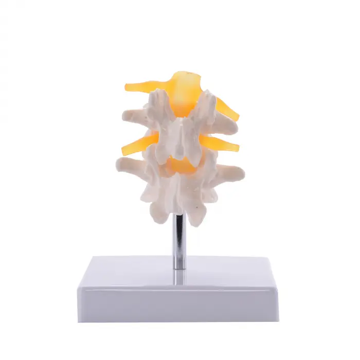 Anatomische Lendenwirbelsäule, 2tlg.