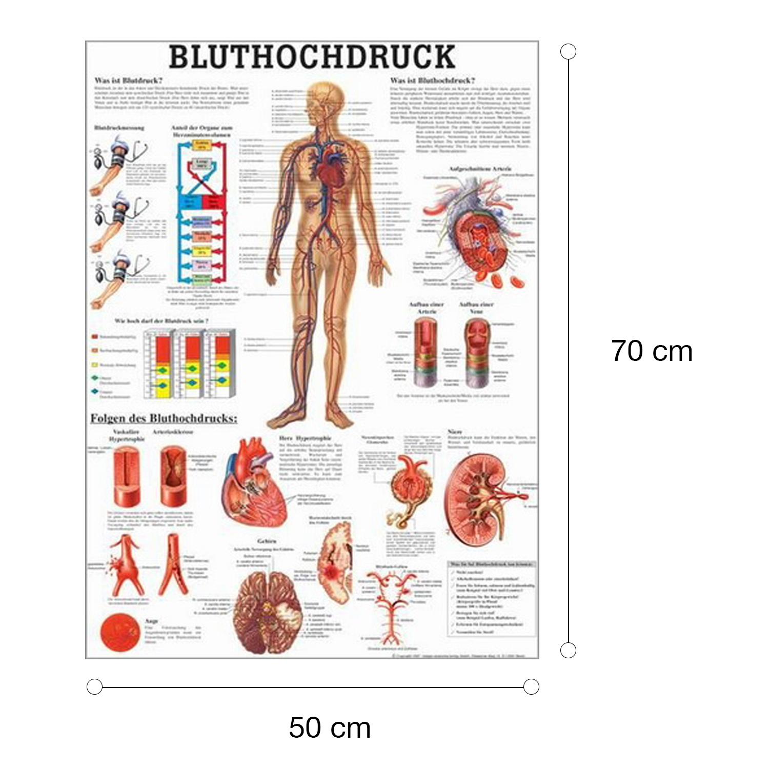 Bluthochdruck Bluthochdruck des Menschen | Poster 50 x 70 cm | unlaminiert