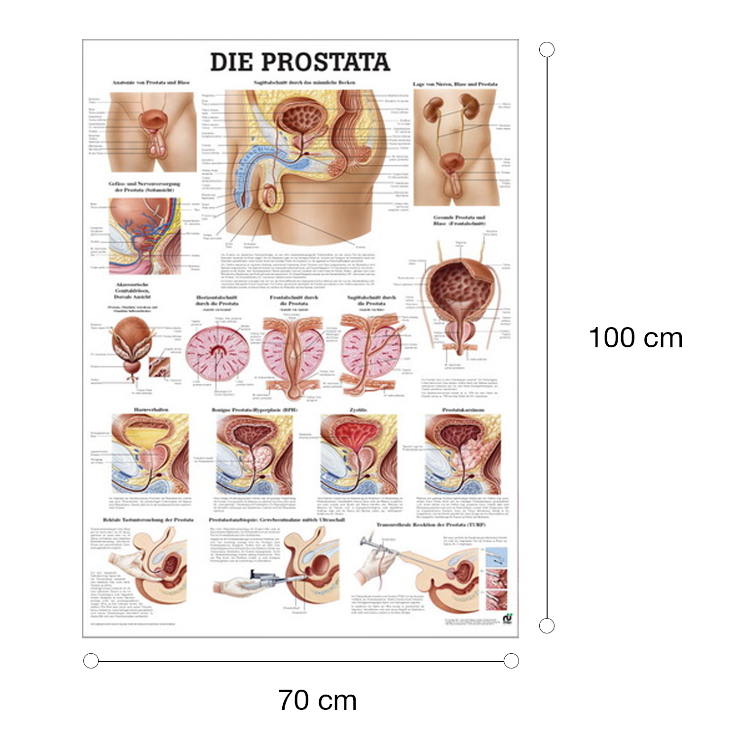 Lehrtafel "Prostata" Prostata | Lehrtafel 70 x 100 cm | laminiert